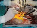 Православный взгляд на трансплантацию органов